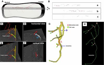 3D Digital Anatomic Angioarchitecture of the Rat Spinal Cord: A Synchrotron Radiation Micro-CT Study